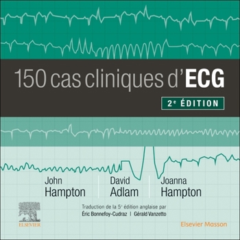 Paperback 150 Cas Cliniques d'Ecg [French] Book
