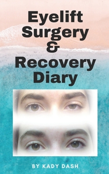 Paperback Eyelift Surgery and Recovery Diary: Ptosis, eyelifts, punctal plugs, and dry eyes Book