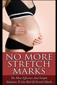 Paperback No More Stretch Marks: The Most Effective and Simple Solutions to Get Rid of Stretch Marks Book