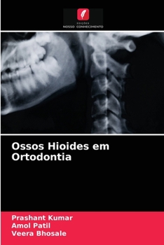 Paperback Ossos Hioides em Ortodontia [Portuguese] Book