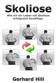 Paperback Skoliose: Wie ich ein Leben mit Skoliose erfolgreich bewältige [German] Book