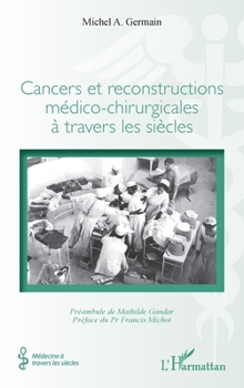 Cancers et reconstructions médico-chirurgicales à travers les siècles (Médecine À Travers Les Siècles) (French Edition)
