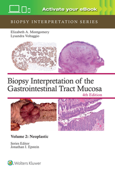 Hardcover Biopsy Interpretation of the Gastrointestinal Tract Mucosa Volume 2: Neoplastic: Print + eBook with Multimedia Volume 2 Book