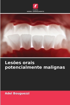 Paperback Lesões orais potencialmente malignas [Portuguese] Book