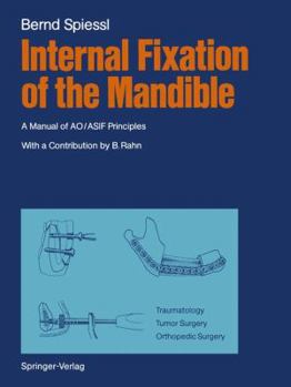 Paperback Internal Fixation of the Mandible: A Manual of Ao/Asif Principles Book