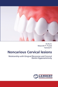 Paperback Noncarious Cervical lesions Book