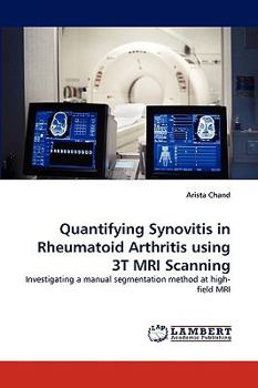 Paperback Quantifying Synovitis in Rheumatoid Arthritis using 3T MRI Scanning Book