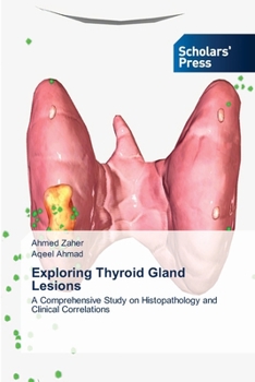 Paperback Exploring Thyroid Gland Lesions Book