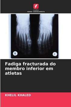 Paperback Fadiga fracturada do membro inferior em atletas [Portuguese] Book
