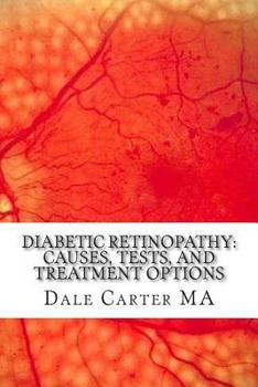 Paperback Diabetic Retinopathy: Causes, Tests, and Treatment Options Book