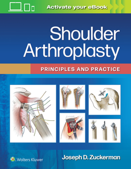 Hardcover Shoulder Arthroplasty: Principles and Practice Book