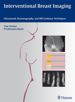 Hardcover Interventional Breast Imaging: Ultrasound, Mammography, and MR Guidance Techniques Book