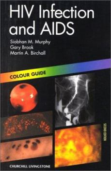 Paperback HIV Infection and Aids: Colour Guide (Colour Guides) Book