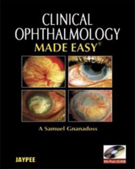 Hardcover Clinical Ophthalmology Made Easy Book