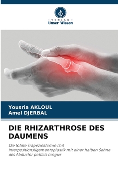 Die Rhizarthrose Des Daumens (German Edition)