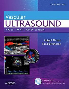 Hardcover Vascular Ultrasound: How, Why and When Book