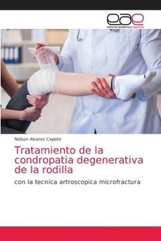 Tratamiento de la condropatia degenerativa de la rodilla (Spanish Edition)