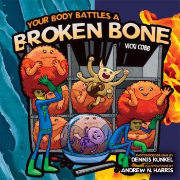 Library Binding Your Body Battles a Broken Bone Book