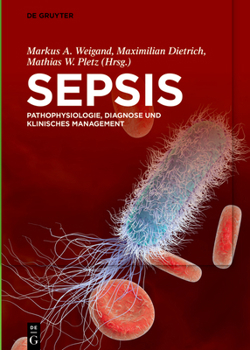 Sepsis: Pathophysiologie, Diagnose Und Klinisches Management