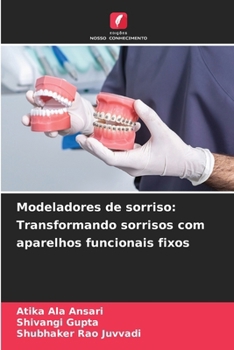 Modeladores de sorriso: Transformando sorrisos com aparelhos funcionais fixos (Portuguese Edition)