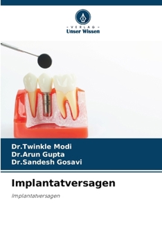 Paperback Implantatversagen [German] Book