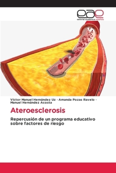 Paperback Ateroesclerosis [Spanish] Book