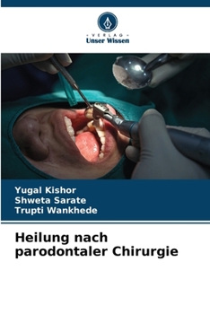 Paperback Heilung nach parodontaler Chirurgie [German] Book