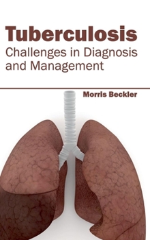 Hardcover Tuberculosis: Challenges in Diagnosis and Management Book
