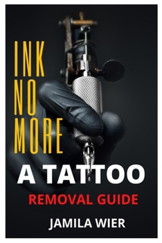 Ink No More: A Tattoo Removal Guide