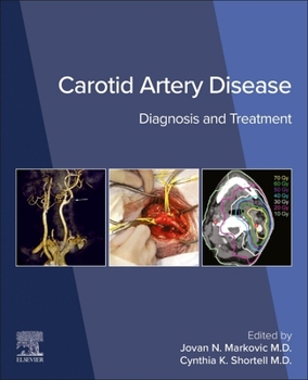 Paperback Carotid Artery Disease: Diagnosis and Treatment Book