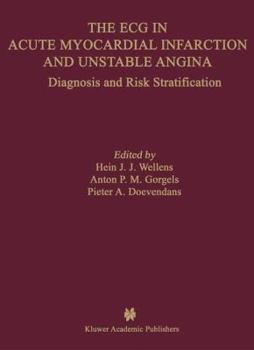 Paperback The ECG in Acute Myocardial Infarction and Unstable Angina: Diagnosis and Risk Stratification Book