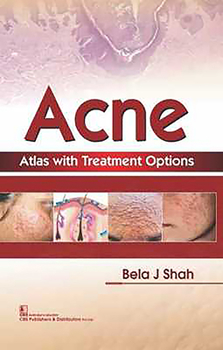 Hardcover Acne Atlas with Treatment Options Book