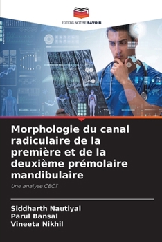 Paperback Morphologie du canal radiculaire de la première et de la deuxième prémolaire mandibulaire [French] Book