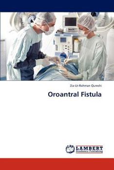 Paperback Oroantral Fistula Book