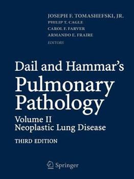 Paperback Dail and Hammar's Pulmonary Pathology: Volume II: Neoplastic Lung Disease Book