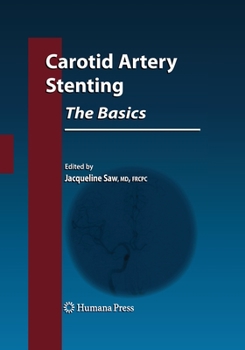 Paperback Carotid Artery Stenting: The Basics Book