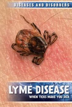 Paperback Lyme Disease: When Ticks Make You Sick Book
