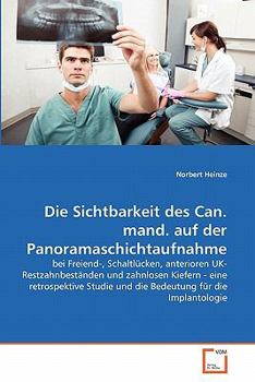 Paperback Die Sichtbarkeit des Can. mand. auf der Panoramaschichtaufnahme [German] Book