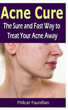 Paperback Acne Cure: The Sure and Fast Way to Treat Your Acne Away Book