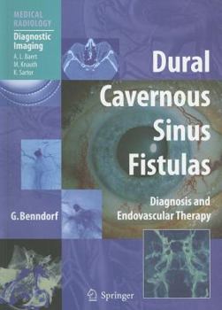 Paperback Dural Cavernous Sinus Fistulas: Diagnosis and Endovascular Therapy Book