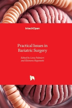 Practical Issues in Bariatric Surgery