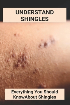Paperback Understand Shingles: Everything You Should Know About Shingles: Shingles Topical Treatment Book