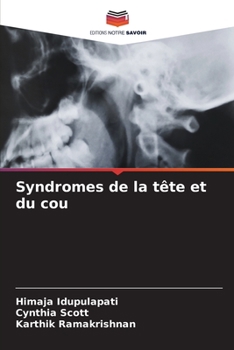 Paperback Syndromes de la tête et du cou [French] Book