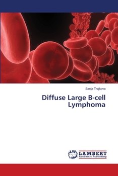 Paperback Diffuse Large B-cell Lymphoma Book