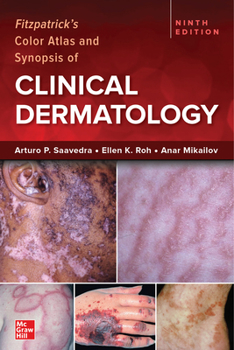 Paperback Fitzpatrick's Color Atlas and Synopsis of Clinical Dermatology, Ninth Edition Book