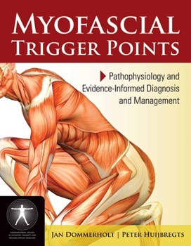 Paperback Myofascial Trigger Points: Pathophysiology and Evidence-Informed Diagnosis and Management: Pathophysiology and Evidence-Informed Diagnosis and Managem Book