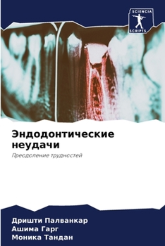 Paperback Эндодонтические неудач&# [Russian] Book