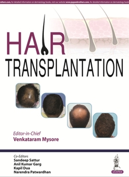 Hardcover Hair Transplantation Book