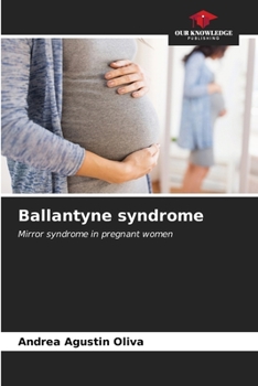 Paperback Ballantyne syndrome Book