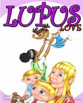 Paperback Lupus Love Book